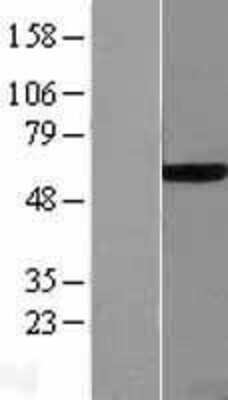 Western Blot: Endothelial Lipase Overexpression Lysate [NBL1-12550]