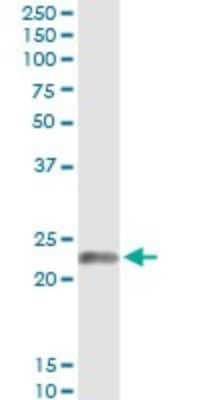 Immunoprecipitation: Endothelin-1 Antibody (3D6) [H00001906-M01]