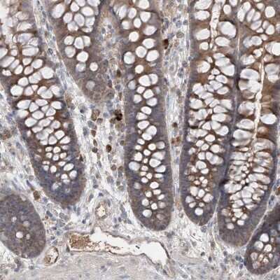 Immunohistochemistry-Paraffin: Endothelin-1 Antibody [NBP1-84779]