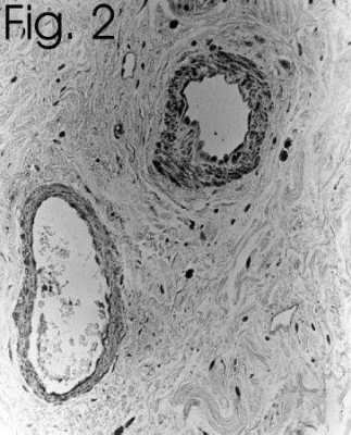 Immunohistochemistry: Endothelin-1 Antibody (TR.ET.48.5) - BSA Free [NB300-526]