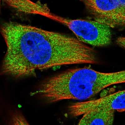Immunocytochemistry/ Immunofluorescence: Endothelin 2 Antibody [NBP1-87942]