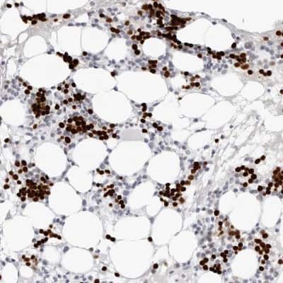 Immunohistochemistry-Paraffin: Endothelin 2 Antibody [NBP1-87942]