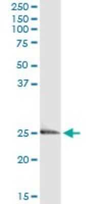 Immunoprecipitation: Endothelin-3 Antibody (2A6-2A4) [H00001908-M01]