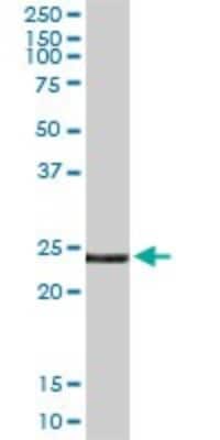 Western Blot: Endothelin-3 Antibody [H00001908-D01P]