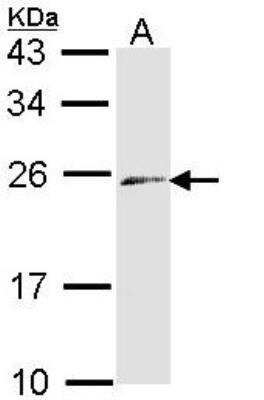 Western Blot: Endothelin-3 Antibody [NBP1-33578]