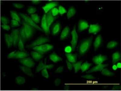 Immunocytochemistry/ Immunofluorescence: Enolase 1 Antibody (8G8) [H00002023-M01]