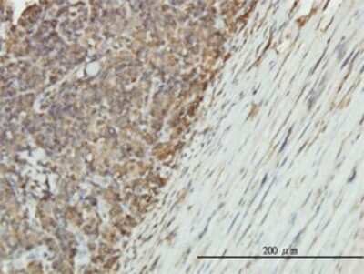 Immunohistochemistry-Paraffin: Enolase 1 Antibody (8G8) [H00002023-M01]