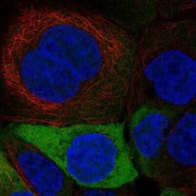 Immunocytochemistry/ Immunofluorescence: Enolase 1 Antibody [NBP2-68874]