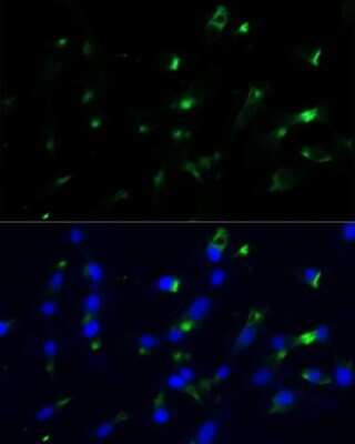 Immunocytochemistry/ Immunofluorescence: Enolase 1 Antibody - Azide and BSA Free [NBP3-03484]