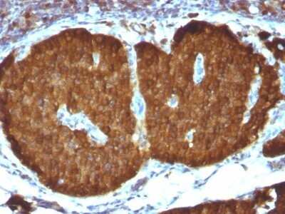 Immunohistochemistry-Paraffin: Enolase 2/Neuron-specific Enolase Antibody (ENO2/1375) - Azide and BSA Free [NBP2-54452]