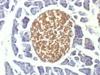 Immunohistochemistry-Paraffin: Enolase 2/Neuron-specific Enolase Antibody (ENO2/1375) - Azide and BSA Free [NBP2-54452]