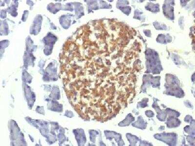 Immunohistochemistry-Paraffin: Enolase 2/Neuron-specific Enolase Antibody (ENO2/1375) [NBP2-47635]