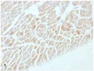 Immunohistochemistry-Paraffin: Enolase 2/Neuron-specific Enolase Antibody (ENO2/1462) - Azide and BSA Free [NBP2-59603]