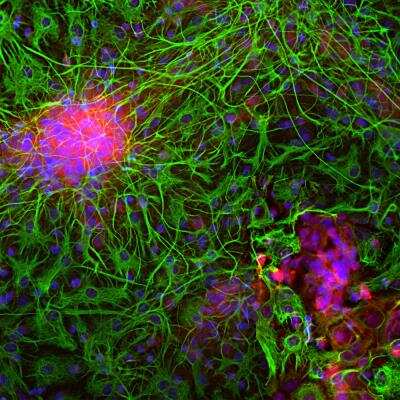 Immunocytochemistry/ Immunofluorescence: Enolase 2/Neuron-specific Enolase Antibody [NB110-58870]