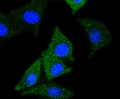 Immunocytochemistry/ Immunofluorescence: Enolase 2/Neuron-specific Enolase Antibody (SC06-28) [NBP2-67641]