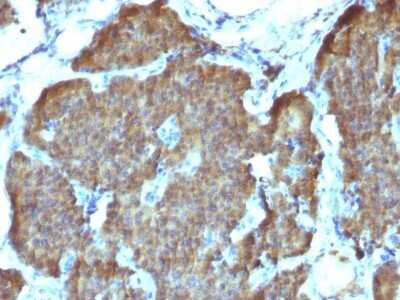 Immunohistochemistry-Paraffin: Enolase 2/Neuron-specific Enolase Antibody (SPM347) [NBP2-53158]