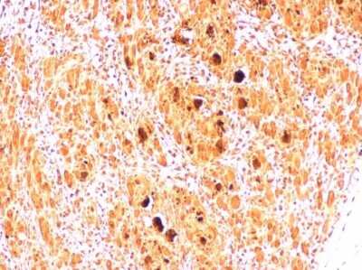 Immunohistochemistry-Paraffin: Enterovirus 71 2B Antibody [NBP3-13090]