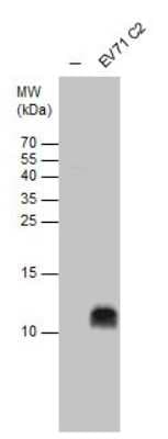 Western Blot: Enterovirus 71 2B Antibody [NBP3-13090]