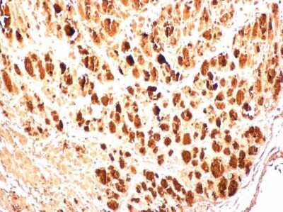 Immunohistochemistry-Paraffin: Enterovirus 71 3AB Antibody [NBP3-13091]
