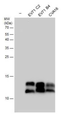 Western Blot: Enterovirus 71 3AB Antibody [NBP3-13091]