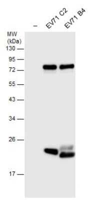 Western Blot: Enterovirus 71 3C Antibody [NBP3-13098]