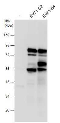 Western Blot: Enterovirus 71 3CD Antibody [NBP3-13096]