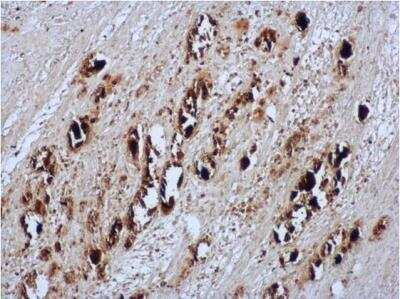 Immunohistochemistry-Paraffin: Enterovirus 71 Antibody [NBP2-42843]