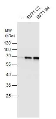 Western Blot: Enterovirus 71 Antibody [NBP2-42843]