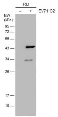 Western Blot: Enterovirus 71 VP1 Antibody (GT9512) [NBP3-13544]