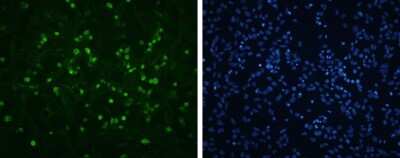 Immunocytochemistry/ Immunofluorescence: Enterovirus 71 VP1 Antibody [NBP3-13086]