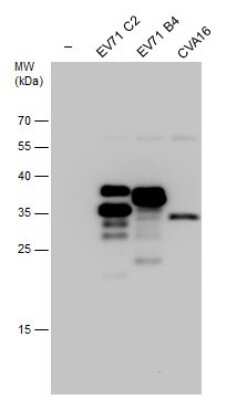 Western Blot: Enterovirus 71 VP1 Antibody [NBP3-13086]