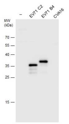 Western Blot: Enterovirus 71 VP1 Antibody [NBP3-13087]