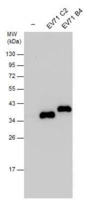 Western Blot: Enterovirus 71 VP1 Antibody [NBP3-13117]