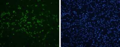 Immunocytochemistry/ Immunofluorescence: Enterovirus 71 VP2 Antibody [NBP3-13088]