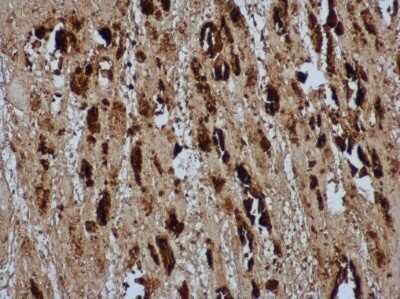 Immunohistochemistry-Paraffin: Enterovirus 71 VP2 Antibody [NBP3-13088]