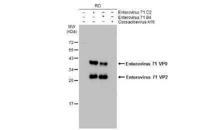 Western Blot: Enterovirus 71 VP2 Antibody [NBP3-13088]