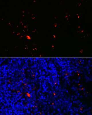 Immunohistochemistry: Eosinophil derived neurotoxin Antibody - BSA Free [NBP3-03635]