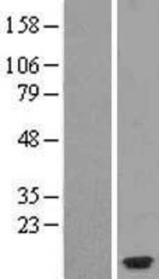 Western Blot: CCL26/Eotaxin-3 Overexpression Lysate [NBL1-08854]