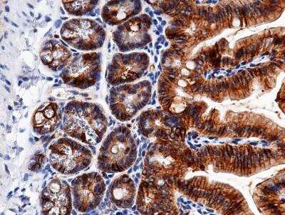 Immunohistochemistry-Paraffin: EpCAM/TROP1 Antibody (002) [NBP2-89589]