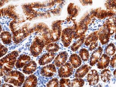 Immunohistochemistry-Paraffin: EpCAM/TROP1 Antibody (065) [NBP2-90654]