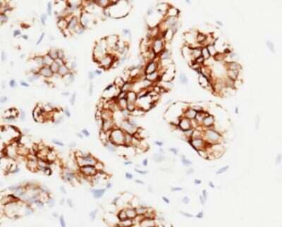 Immunohistochemistry-Paraffin: EpCAM/TROP1 Antibody (28) [NBP2-89605]