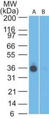 Western Blot: EpCAM/TROP1 Antibody (60N5D8)Azide and BSA Free [NBP2-80722]