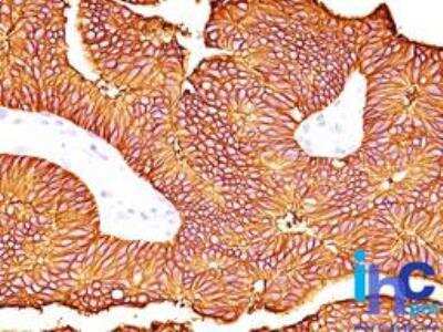 Immunohistochemistry-Paraffin: EpCAM/TROP1 Antibody (60N5D8) - BSA Free [NBP2-22381]