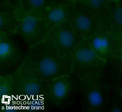 Immunocytochemistry/ Immunofluorescence: EpCAM/TROP1 Antibody (AUA1) - BSA Free [NB600-1182]