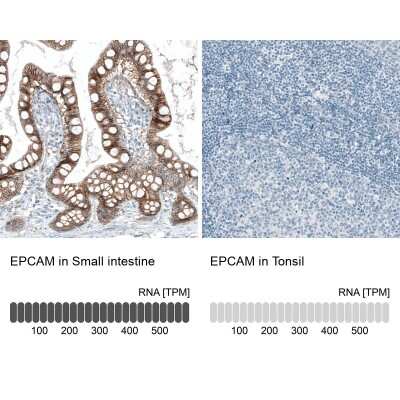 Immunohistochemistry-Paraffin: EpCAM/TROP1 Antibody (CL6313) [NBP2-76486]