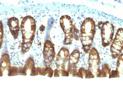 Immunohistochemistry-Paraffin: EpCAM/TROP1 Antibody (EGP40/1110) - (ECD) - Azide and BSA Free [NBP2-47873]