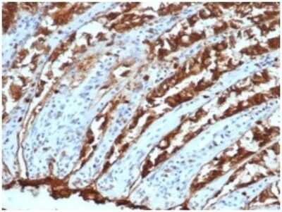 Immunohistochemistry-Paraffin: EpCAM/TROP1 Antibody (EGP40/1110) - (ECD) - Azide and BSA Free [NBP2-47873]