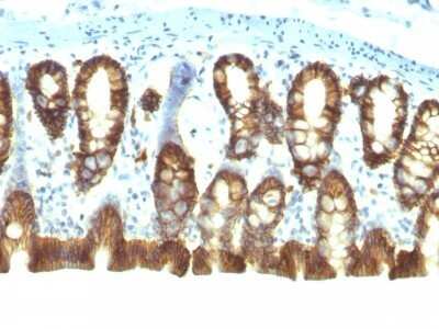 Immunohistochemistry-Paraffin: EpCAM/TROP1 Antibody (EGP40/1110) - (ECD) [NBP2-44635]