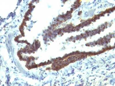 Immunohistochemistry-Paraffin: EpCAM/TROP1 Antibody (EGP40/1110) - (ECD) [NBP2-44635]