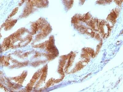 Immunohistochemistry-Paraffin: EpCAM/TROP1 Antibody (EGP40/1110) - (ECD) [NBP2-44635]